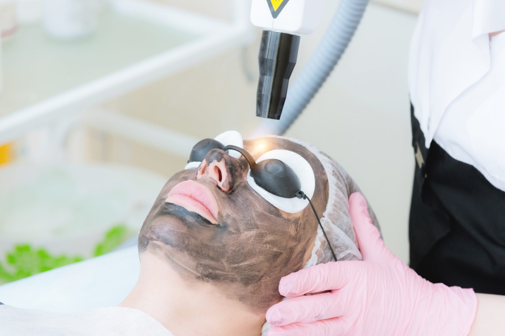 الليزر الكربوني.. تقنية تجميلية لتقشير البشرة وتنظيفها، هل هي الحل الأمثل؟