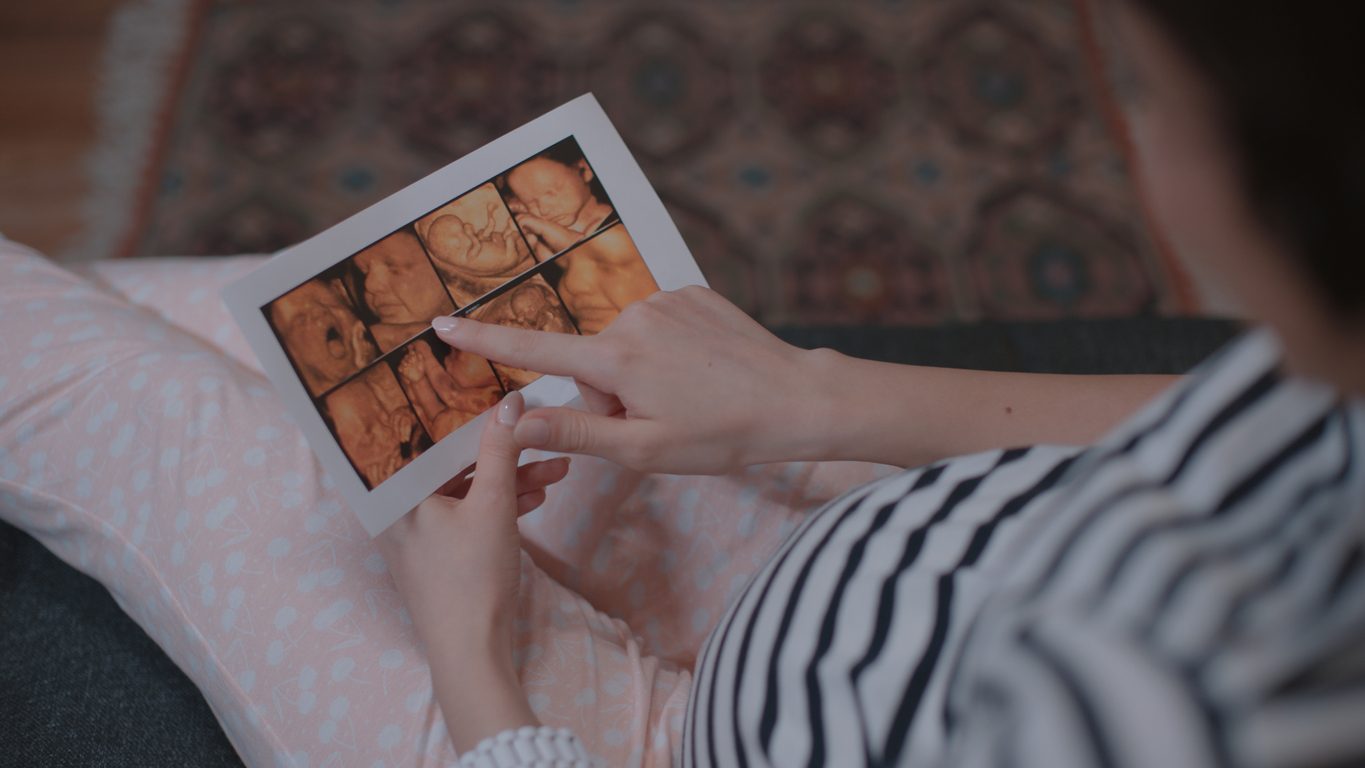 iStock/ ما الذي يراه الأجنّة قبل الولادة؟