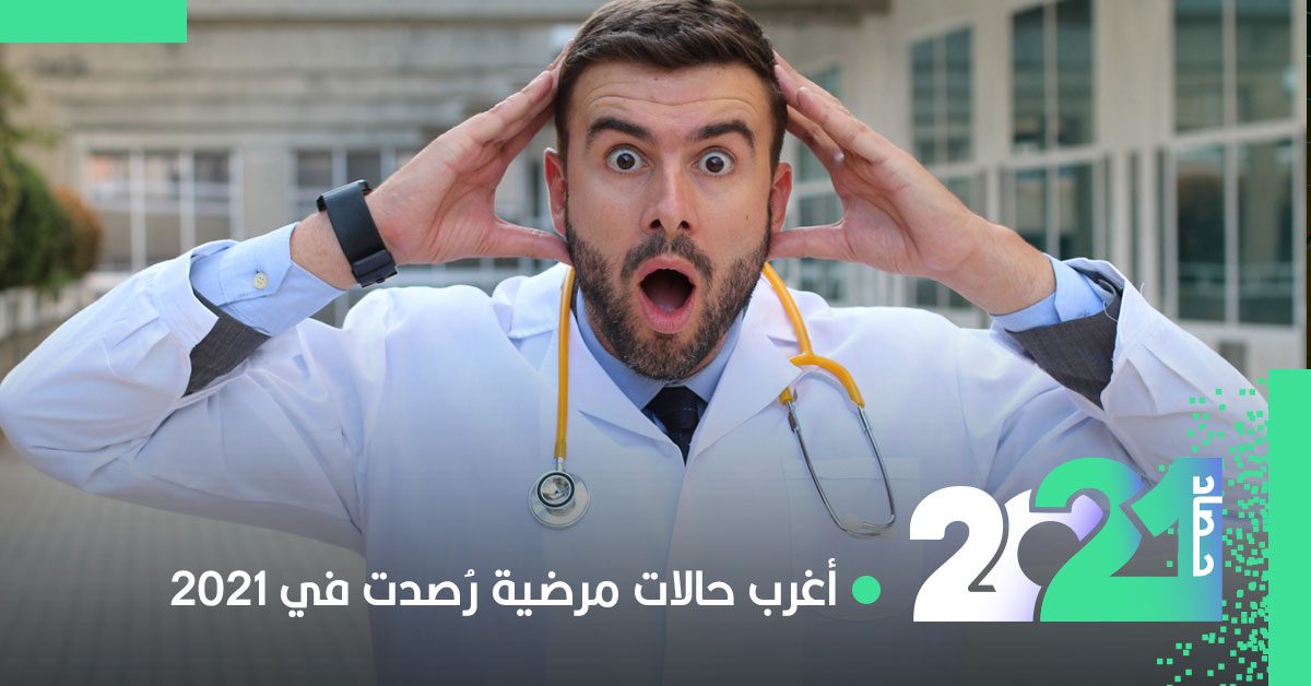 رجل يحمل قطعة أسمنت في قلبه وصبي بلسان أصفر.. أغرب حالات مَرضية في عام 2021
